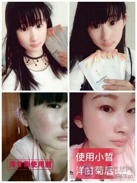揭发!!顾客反馈用了小皙面膜皮肤变得特别油!